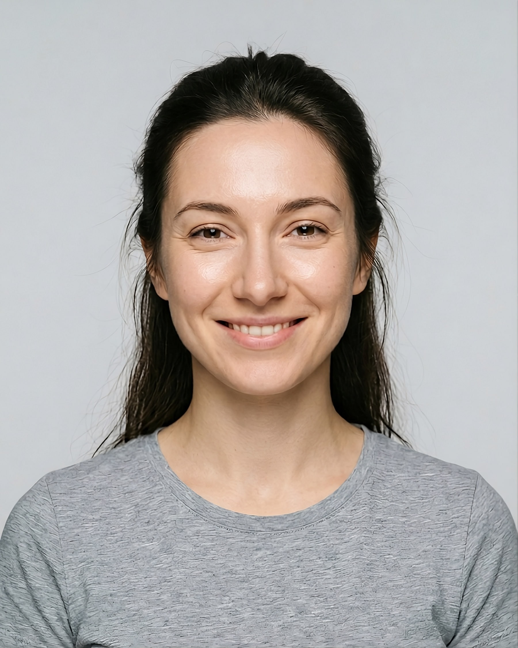 המחשה ויזואלית — אותה מטופלת אחרי ניתוח אף — אותה זווית חזיתית, קצה אף מעודן